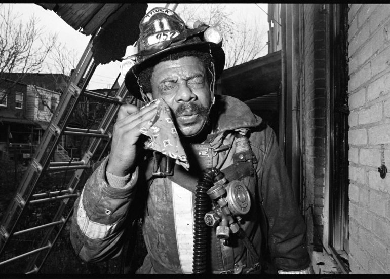 Truck 11 Firefighter Jimmie Hayes removes glass from eye, Fire, Riggs Avenue